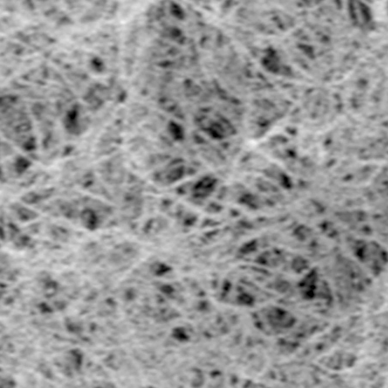 Caractérisation par cryo MEB d'un système auto-assemblé dans son état natif
